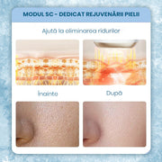 Epilator IPL Xenomo® LUMISKIN